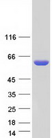 protq96t60 pnk pnkp human recombinant protein