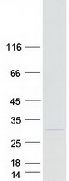 protq99218 amely human recombinant protein