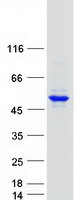 Coomassie blue staining of purified PCYT2 protein