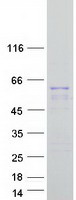 Coomassie blue staining of purified KRT12 protein