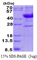 protq99519 sdspage human neu 1 sialidase 1 recombinant protein