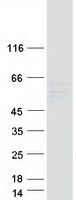 protq99542 mmp19 human recombinant protein