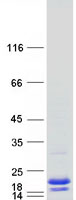 protq99576 tsc22d3 human recombinant protein