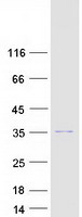 Coomassie blue staining of purified TSNAX protein