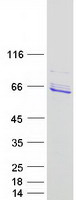 protq99615 dnajc7 human recombinant protein