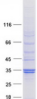 protq99619 spsb2 human recombinant protein