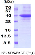 3ug by SDS-PAGE under reducing condition and visualized by coomassie blue stain.