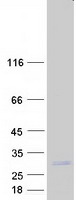 Coomassie blue staining of purified COPS8 protein