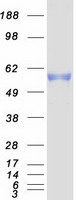 Coomassie blue staining of purified PKMYT1 protein