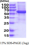 protq99706 sdspage human kir2dl4 cd158d recombinant protein