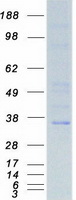Coomassie blue staining of purified NKX3-1 protein