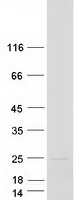 Coomassie blue staining of purified COQ7 protein