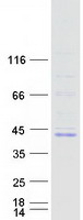 Coomassie blue staining of purified FOXB1 protein