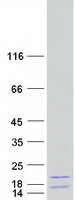 protq99878 hist1h2aj human recombinant protein