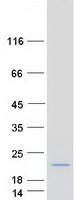 protq99879 hist1h2bm human recombinant protein