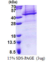 3ug by SDS-PAGE under reducing condition and visualized by coomassie blue stain.