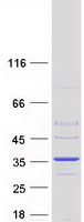 protq9bpw9 dhrs9 human recombinant protein