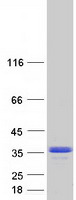 protq9bq65 c16orf57 usb1 human recombinant protein