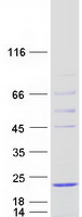 protq9bqs6 b9hsp hspb9 human recombinant protein