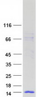 protq9bqy6 wfdc6 human recombinant protein