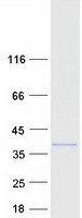 Coomassie blue staining of purified DBNDD2 protein
