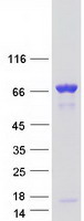 Coomassie blue staining of purified CORO1B protein