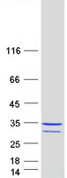 Coomassie blue staining of purified PYM1 protein