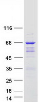 Coomassie blue staining of purified ARHGAP9 protein