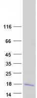 protq9brs8 larp6 human recombinant protein
