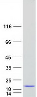 Coomassie blue staining of purified MIEN1 protein