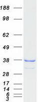 protq9bsh4 taco1 human recombinant protein
