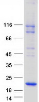 protq9bsk0 marveld1 human recombinant protein
