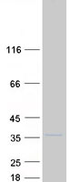 Coomassie blue staining of purified SLC25A33 protein