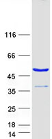 Coomassie blue staining of purified UBAC1 protein