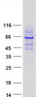 Coomassie blue staining of purified RTKN protein