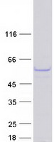 protq9btk6 pa1 pagr1 human recombinant protein