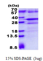 3ug by SDS-PAGE under reducing condition and visualized by coomassie blue stain.
