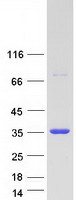 Coomassie blue staining of purified HTATIP2 protein