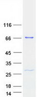 Coomassie blue staining of purified THUMPD3 protein