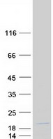 protq9bv90 snrnp25 human recombinant protein