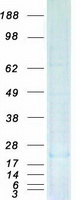 protq9bvj7 dusp23 human recombinant protein