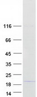 protq9bw61 dda1 human recombinant protein