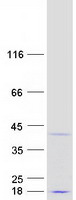 Coomassie blue staining of purified CCDC106 protein