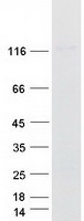 Coomassie blue staining of purified CARD10 protein