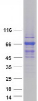 protq9bxi6 tbc1d10a human recombinant protein
