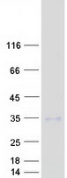 protq9bxj4 ctrp3 c1qtnf3 human recombinant protein