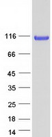 Coomassie blue staining of purified SRRT protein