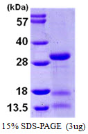 3ug by SDS-PAGE under reducing condition and visualized by coomassie blue stain