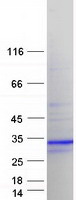 Coomassie blue staining of purified CALN1 protein