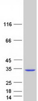 Coomassie blue staining of purified DGCR6L protein
